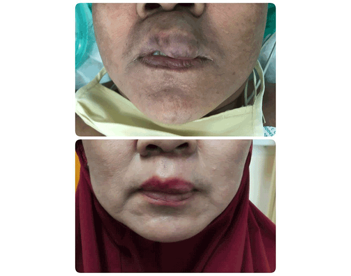 Gambar tidak ditemukan