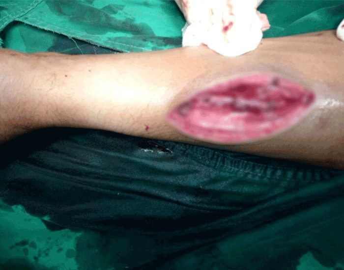 Gambar tidak ditemukan