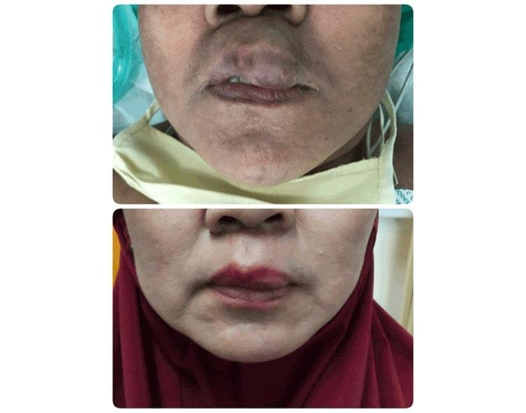 Gambar tidak ditemukan