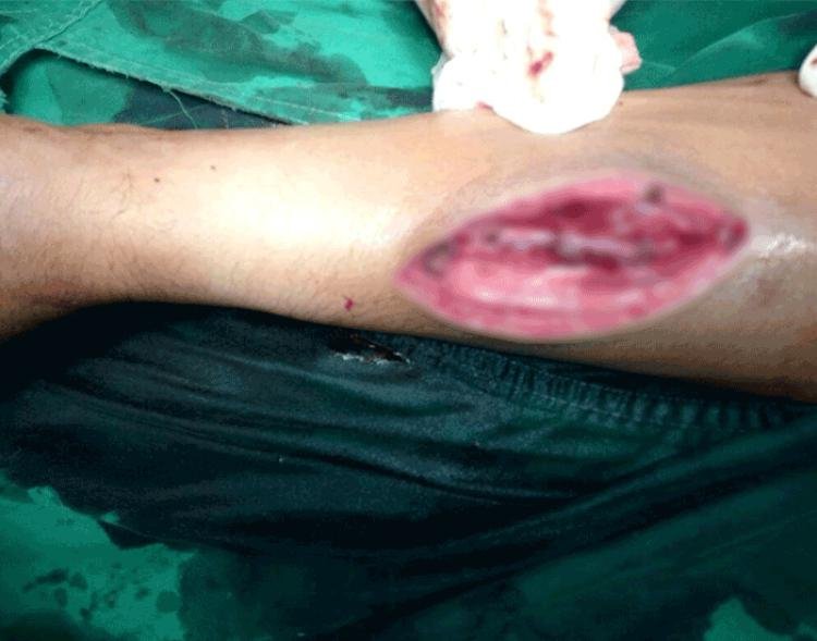 Gambar tidak ditemukan